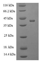 Recombinant Mouse Acetylcholine receptor subunit alpha(Chrna1),partial
