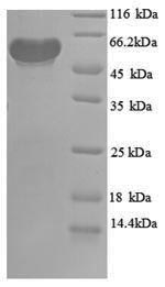 Recombinant Escherichia coli Pyruvate dehydrogenase [ubiquinone](poxB),partial