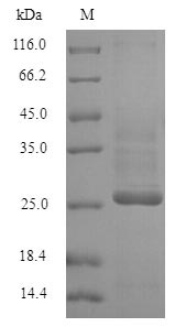 Recombinant Human Potassium voltage-gated channel subfamily D member 1(KCND1),partial