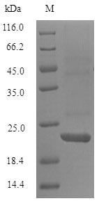 Recombinant Mouse B-lymphocyte antigen CD20(Ms4a1),partial