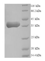 Recombinant Human Pro-neuregulin-2, membrane-bound isoform(NRG2),partial