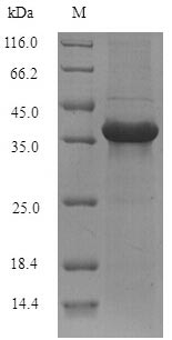Recombinant Mouse Alpha/beta hydrolase domain-containing protein 11(Abhd11)