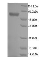 Recombinant Trypanosoma cruzi Trypanothione reductase(TPR)