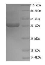 Recombinant Zaire ebolavirus Minor nucleoprotein VP30(VP30)