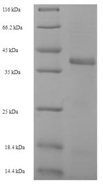 Recombinant Staphylococcus aureus Enoyl-[acyl-carrier-protein] reductase [NADPH] FabI(fabI)