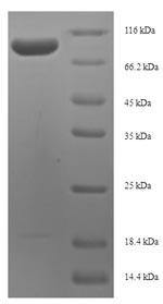 Recombinant Human Antigen KI-67(MKI67),partial
