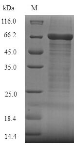 Recombinant Human Fc receptor-like protein 4(FCRL4),partial