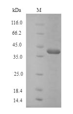 Recombinant Human Protein atonal homolog 1(ATOH1)