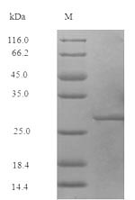 Recombinant Staphylococcus aureus 50S ribosomal protein L7/L12(rplL)
