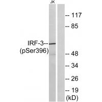 IRF-3 (phospho Ser396) Polyclonal Antibody